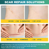 Silicone Scar Sheets (1.6" X 120" Roll-3M), Silicone Scar Tape For Scar Removal Treatment, Silicone Scar Removal Strips For Surgical, C-Section, Tummy Tuck, Keloid Bump Removal