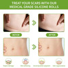 Premium Silicone Scar Tape: Pain-Free, Medical-Grade Solution For All Scars - Easy Application And Remova
