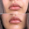 Talika Smile Patch Hydrating Lip Mask Helps To Moisturize Replenish And Nourish The Lips