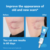 Kelo-Cotee 2 Pack Advanced Formula Scar Gel 15G