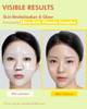 Dermal 39 Combo Pack Sheet Mask + Vitamin Hydrogel Melting Jelly Gel Mask 4Ea Bundle Dermal 39 Combo Pack Sheet Mask + Vitamin Hydrogel Melting Jelly Gel Mask 4Ea Bundle