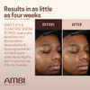Ambi Even & Clear Fade Serum Hyperpigmentation Treatment Hydroquinone Dark Spot Corrector Results In As Little As 4 Weeks Retinol Hyaluronic Acid Niacinamide Ceramides 1 Fl Oz