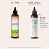 Sky Organics Essential Scalp Elixir For Hair Usda Organic To Hydrate Soothe & Nourish Scalp 6 Fl. Oz
