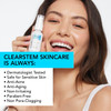CLEARSTEM  CELLRENEW  Collagen Stem Cell Serum  Acne  Youthful Skin Face Serum  Hyaluronic Acid Reishi Aloe Vera  Facial Skin Care Products  Gluten Free Cruelty Free  1 fl oz  29ml