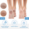 Forpro Professional Collection Premium Callus No More Callus Remover Fast-Acting Callus Removing Formula 32 Oz. Forpro Professional Collection Premium Callus No More Callus Remover Fast-Acting Callus Removing Formula 32 Oz.