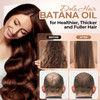 Dolahair Batana Oil For Hair Growth Organics 100% Natural Pure Batana Hair Oil Batana Oil Nourishes Damaged Hair Raw Batana Butter Prevent Hair Loss Natural Hair Growth Oil And Conditioner Beige Dolahair Batana Oil For Hair Growth Organics 100% Natural Pure Batana Hair Oil Batana Oil Nourishes Damaged Hair Raw Batana Butter Prevent Hair Loss Natural Hair Growth Oil And Conditioner Beige