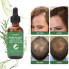 Organic Essential Rosemary Oil For Hair Growth Thin Hair Healthy Scalp And Skin (2.03 Oz)