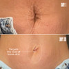 Maëlys Cosmetics B-Flat Belly Firming Cream - Stretch Mark Tightening Belly Cream