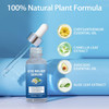 S_Tye Eye Treatment Natural Gentle Ingredient S_Tye Eye Drops Relief Serum For Cleanses Lashes And Eyes Safe & Effective Chalazion And Blepharitis Treatment 30Ml
