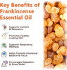 Premium Frankincense Essential Oil – 100% Pure & Natural Therapeutic Grade For Skin Face & Aromatherapy  Best Frankincense Oil For Face Wrinkles & Scars  Deeply Nourishing