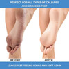 Forpro Professional Collection Advanced Callus Eliminator Gel Professional Grade No Drip Callus Remover Gel For Feet 8 Oz.