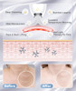 Elishine Light Based Multifunctional Facial Massager 7 Color Portable Face Massager Tool For Skin Care White