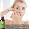 Tea Tree Essential Oil, 1 Fl Oz With Dropper - Undiluted Therapeutic Grade For Your Face, Skin, Hair And Diffuser - 100% Pure Melaleuca Oil For Acne, Toenails - By Pure Body Naturals