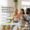 Terrasil Folliculitis Cream, Folliculitis Treatment Of Ingrown Hair & Itching, Clinically Proven 1% Clotrimazole, Natural Ingredients, Scalp, Face & Body, Dermatologist Tested. (1.7 Oz)