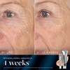 Medik8 Retinal Rewind Kit - Retinal Face Serum and Under Eye Cream for Puffiness and Wrinkles - Smoothing Serum for Face Hydrates Skin - 2 pc