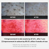 Medicube Swipe & Spray Red Duo For Troubled Skin: Red Succinic Acid Panthenol Facial Peeling Pads And Power Soothing Spray