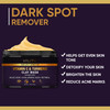 Valitic Vitamin C & Turmeric Clay Mask - Dark Spot Corrector With Kojic Acid Hyaluronic Acid & Retinol - Skin Care Routine For Minimizing Pores & Blackheads - With Applicator Brush - 50G