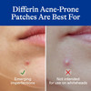 Differin Acne Patches Pimple Patches For Acne Prone Skin Formulated With Salicylic Acid And Centella Fast Triple Action Power Patch For Day & Night Dermatologist Tested 36 Count