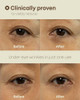Nineless Ever-Youth Dual Effect Eye Cream Korean Skincare Instant Lifting Technology For Firm Eyes With Niacinamide Adenosine Hyaluronic Acid Ceramides For Fine Lines Bags Puffiness 0.5 Fl Oz