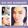 Belli Skincare Acne Control Spot Treatment - Skin Care Treatment - Acne Treatment - Vegan Face Wash - Pregnancy Acne Treatment - Acne Spot Treatment for Face - Face Care