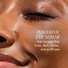 Kat Burki Rose Hip Intense Recovery Eye Serum with 1% Encapsulated Retinol Vitamin C & Niacinamide Reduces Dark Circles Puffiness & Fine Lines 0.5 Fl Oz