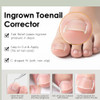 Callmynm Ingrown Toenail Corrector Set Professional Ingrown Nail Treatment Kit With Breathable Correction Strips Curved Patches And Complete Pedicure Tool Set For Pain Relief And Healthy Nail Growth