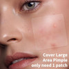 Daolyo Large Pimple Patches For Face 7 Sizes 210 Counts Xl Acne Patches Big Hydrocolloid Bandages For Body Chin Forehead Chest Back Zit Breakouts (Strip Square Round)