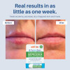 Fixmyskin 1% Hydrocortisone Healing Lip Balm Unflavored Soothes Dry Cracked & Irritated Lips Relieves Chapped Lips Cold Sores & Eczema Dermatologist Developed Travel-Friendly Tube 0.15 Oz