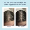 Foundation Skincare Serum For Thinning Hair - Visibly Thicker And Fuller Nourishes And Strengthens With Minoxidil-Free Formula - 2 Fl Oz (30 Day Supply)