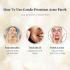Genda Pimple Patches For Face Acne Spot Patches For Zits And Blemish Dots Hydrocolloid Invisible Spot Stickers - 36 Count.