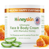 Honeyskin Hydrating Face Moisturizer & Body Cream With Manuka Honey Cream - Organic Face Moisturizer With Honey For Extremely Dry Skin - For Dry & Itchy Skin Rosacea & Eczema Prone Skin 8Oz