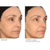 Nassifmd Pro Peptide Collagen Serum Clinical Grade With Premium Ingredients For Hydrated Smooth Skin Lightweight Fast-Absorbing Anti-Aging Formula For Softer Texture And Healthy Glow 1 Oz