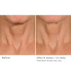 Nassifmd Deco-Lift Neck Firming Complex Serum