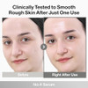 Numbuzin No.4 Ceramide Aha Pha Glazed Skin Prep Serum Gentle Exfoliating Serum With Glycolic Acid & Pha For Smooth Texture & Glass Skin Glow 1.01 Fl Oz