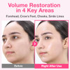 Numbuzin No.2 Sheet Mask | Rose Pdrn Collagen Plumping Sheet Mask | Korean Mask For Face | Brightening Hydrating Firming And Moisturizing | Collagen Peptides Pdrn | 4Ea