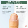 Poderm 100% Natural Nail Repair - Revitalizes Damaged And Split Nails With Hydrating & Exfoliating Formula Effective Nail Care : Also Acts As A Nail Strengthener For Damaged Nails Swiss Made