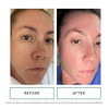 Replenix Glycolic Acid Resurfacing Facial Cleanser Gentle Medical Grade Exfoliating Face Wash For Skin Discoloration (6.7 Fl. Oz)