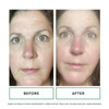 Replenix Anti-Aging Hyaluronic Acid Hydration Face Serum With Medical-Grade Ingredients (1 Fl. Oz)