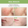 Tosowoong Heartleaf Face Toner With 970200Ppm Heartleaf Water Centella Hyaluronic Acid Witch Hazel Trouble Care Acne-Prone Calming Hydrating Purifying Korean Skin Care 250Ml 8.45 Fl.Oz.
