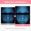 Tosowoong Pdrn Hyaluron Face Cream 5000Ppm Salmon Dna Niacinamide Hyaluronic Acid And Panthenol Moisturizer For Hydrating & Firming Uneven Skin Tone Care Korean Skincare 50Ml / 1.69 Fl. Oz.