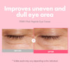Tosowoong Pdrn Pink Peptide Eye Cream With Salmon Dna Pdrn 5000Ppm Anti Aging Formula With Caffeine & Liposome Retinol For Fine Lines Dark Circles And Wrinkles Korean Skincare 30Ml / 1.01 Fl.Oz.