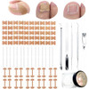 Tyalfrich Ingrown Toenail TreatmentProfessional Ingrown Toenail Removal KitHome Care Nail Clipper Set Suitable For Foot Care Repair