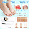 Tyalfrich Ingrown Toenail TreatmentProfessional Ingrown Toenail Removal KitHome Care Nail Clipper Set Suitable For Foot Care Repair