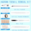 Tyalfrich Ingrown Toenail TreatmentProfessional Ingrown Toenail Removal KitHome Care Nail Clipper Set Suitable For Foot Care Repair