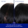 Augustinus Bader Women'S The Scalp Treatment