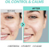 Coxir Tea Tree Pore & Sebum Emulsion For Oil Balance Pore Minimizer Sebum Control Paraben Free Cruelty Free Korean Skin Care [100Ml/3.38 Fl.Oz]