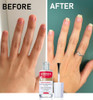 Mavala Mavaderma Nourishing Massage Oil For Nails Nail Care Nail Hardener Cuticle Oil Nail Growth Moisturizing & Healing Treatment For Cracked Nails & Rigid Cuticles (0.3 Ounce)
