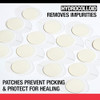 Neutrogena Stubborn Acne Ultra-Thin Patches For Acne-Prone Skin - Hydrocolloid Overnight Blemish Patch For Clear Skin 24 Patches