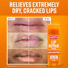 O'Keeffe'S Lip Repair Unscented Lip Balm For Dry Cracked Lips - Stick (3 Pack) - Moisturizer For Very Dry Lips