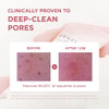 Skin1004 Poremizing Deep Cleansing Foam 4.23 Fl.Oz 125Ml Makeup Remover Korean Face Cleanser With Himalayan Pink Salt & Madagascar Centella Asiatica For Facial Pore Cleansing Korean Skin Care